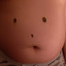 leetBistredirect515